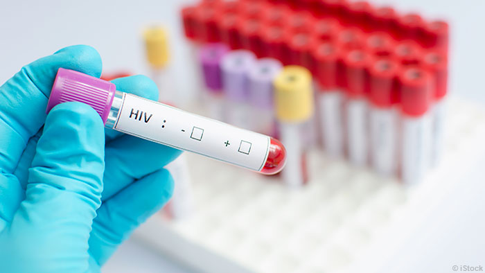 HIVԺ