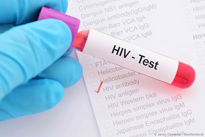 ȾHIV೤ʱܻܲã